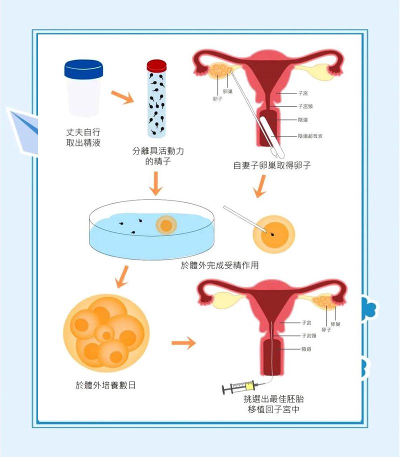 试管婴儿技术：成功案例背后的秘密