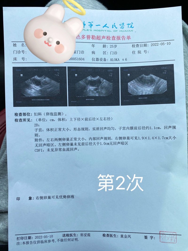 卵泡监测