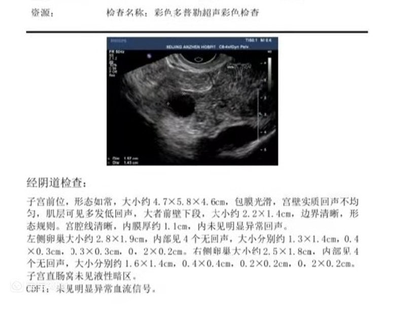 试管婴儿技术，让生育不再遥不可及。
